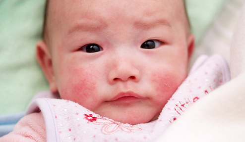 bí quyết chăm con, sức khỏe cho con yêu, chăm con, trị nẻ mùa đông.